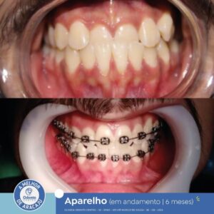 ortodontia-1